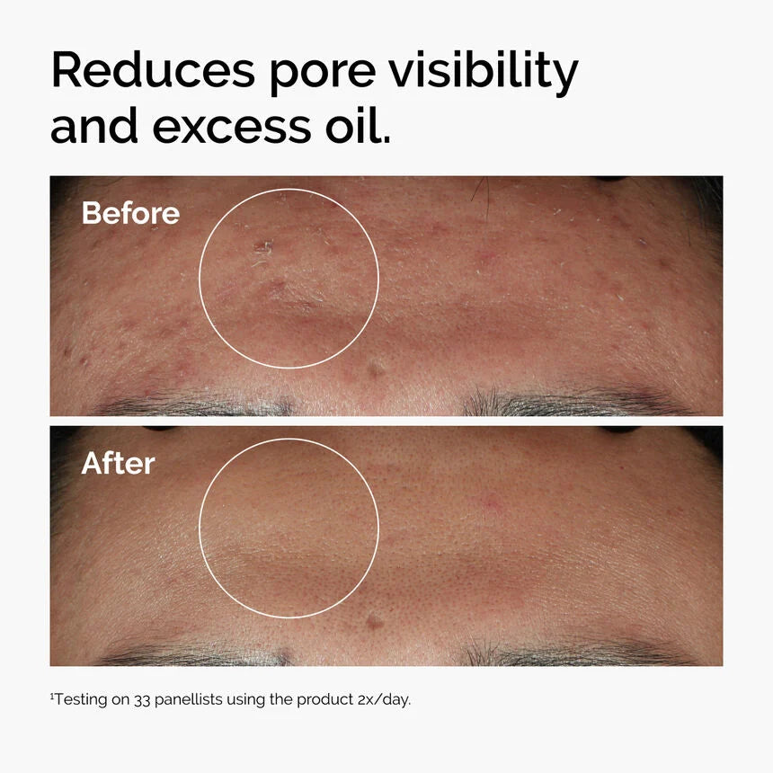 The Ordinary Niacinamide 10% + Zinc 1% (30ML)