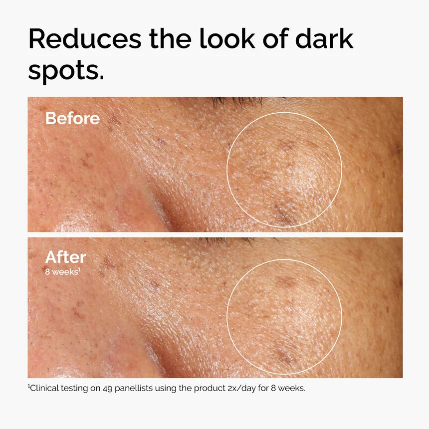 The Ordinary Alpha Arbutin 2% + HA (30ML)